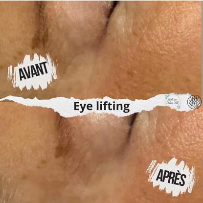 soin visage yeux lifting institut clermont ferrand