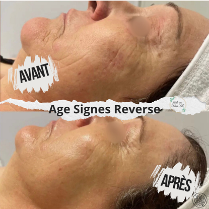 soin visage anti rides age signes reverse institut beaute 63