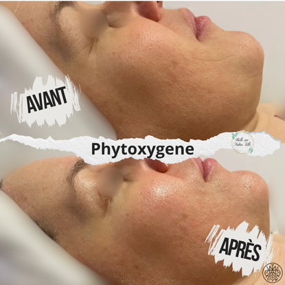 soin visage oxygenation phytoxygene clermont ferrand